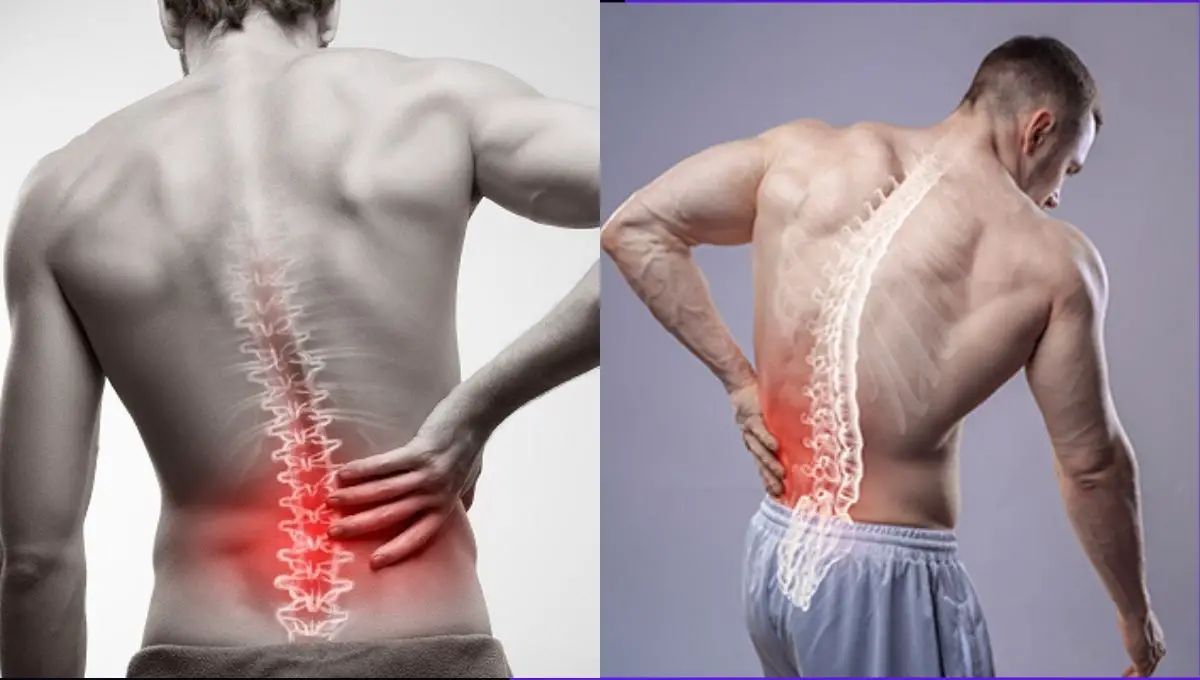 Causes and types of crossfit back injury