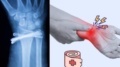 Types of crossfit wrist injury and recovery